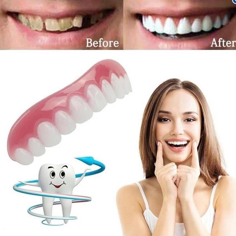 PERFECT SMILE VENEERS - уникальное приспособление, которое сделает вашу улыбку неотразимой. С помощью него вы перестанете стесняться своих зубов 